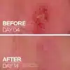 ⁦لاروش بوزيه سيكابلاست مرمم للبشرة - 40 مل | La Roche-Posay Cicaplast Balm B5+ Ultra Repairing Soothing Balm - 40ml⁩ - الصورة ⁦3⁩