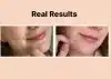 ⁦Cosrx Acne Pimple Master Patch - 24 Pimple Treatment Patch | كوزركس لصقات موضعية لعلاج الحبوب - 24 قطعة⁩ - الصورة ⁦3⁩