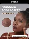⁦COSRX The Alpha Arbutin 2 Discoloration Care Serum - 50ml | كوزركس سيروم ألفا اربوتين لعلاج التصبغات - 50 مل⁩ - الصورة ⁦3⁩